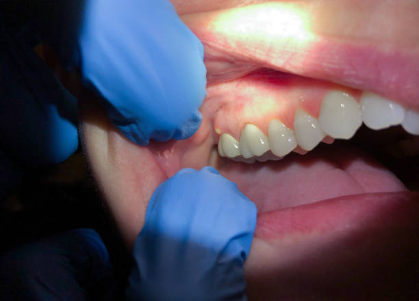 Best Emergency Denture Repair in Pelzer, SC